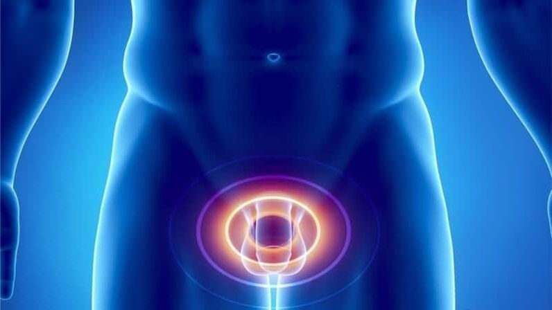 Bolečina za prostatitis